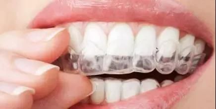 transparent retainer for orthodontic