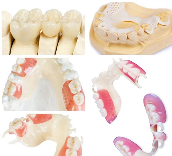 aplicación de acetal dental pmma