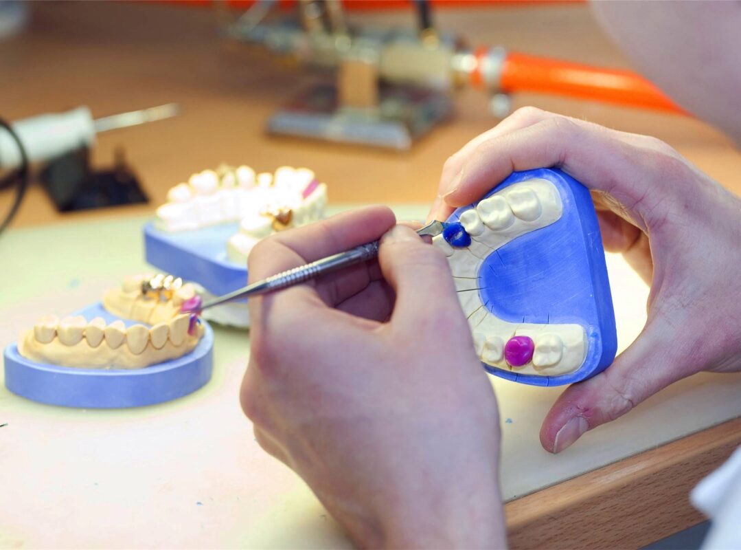 dentaduras postizas hechas en laboratorio dental