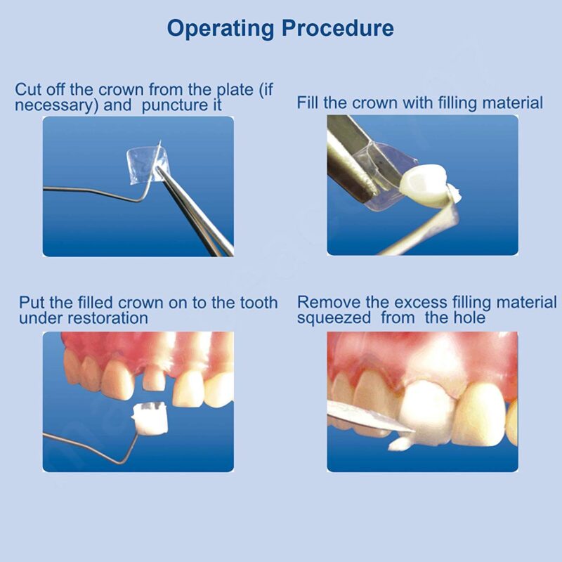 Crowns Matrices Matrix View Cost, Unique Dental Collections