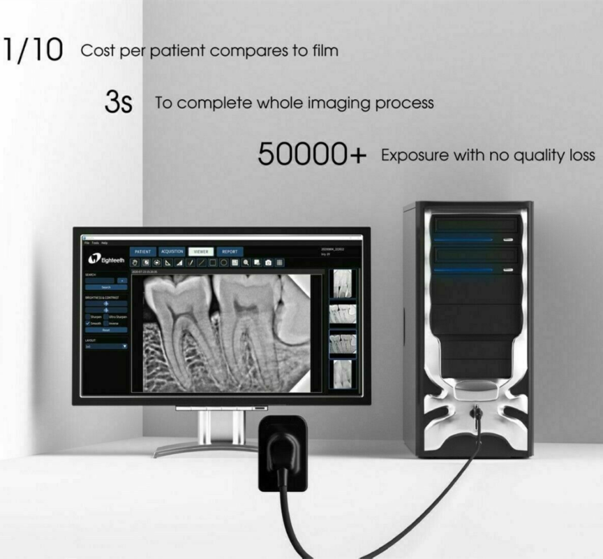 Dental Intraoral X-ray Sensors - View Cost, Unique Dental Collections