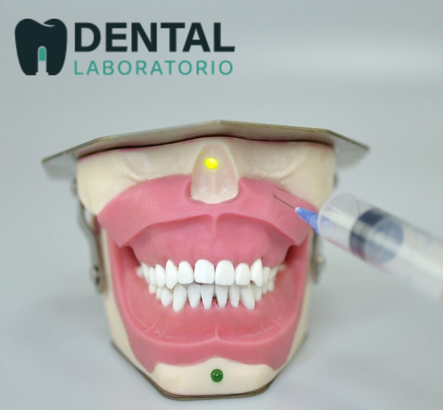 Dental Anesthesia Model Simulation - View Cost, Unique Dental Collections