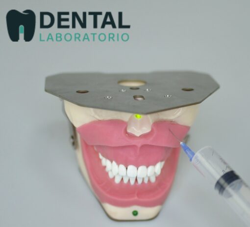 Dental Anesthesia Tooth Extraction Model