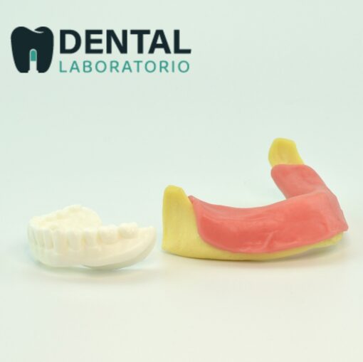 implant-supported dentures training model